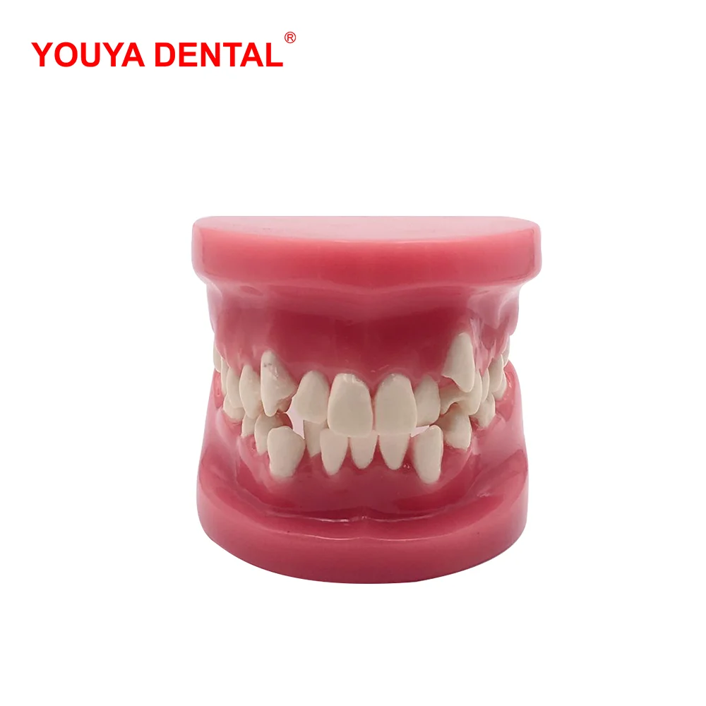 Diş hekimi öğrencilerine Oral tıbbi diş hekimliği ürünlerini inceleyen demostrasyon için 3D reçine diş modeli diş maloklüzyon modeli