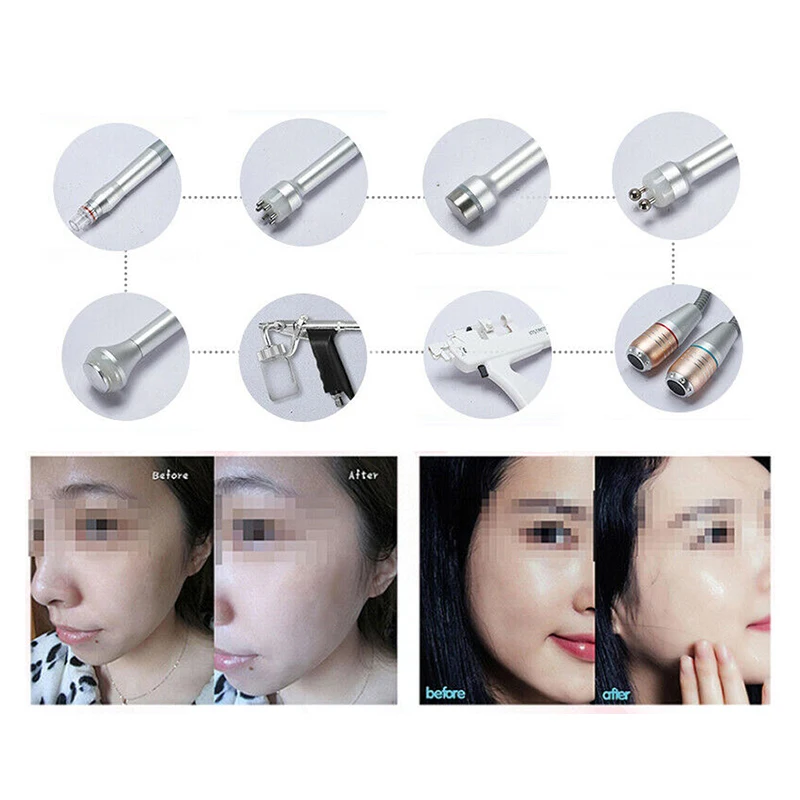 11 in 1 Hydra Dermabrasion RF Bio-lifting Microdermabrasion Facial Machine Water Oxygen Jet Hydro Diamond Peeling Beauty | Красота и
