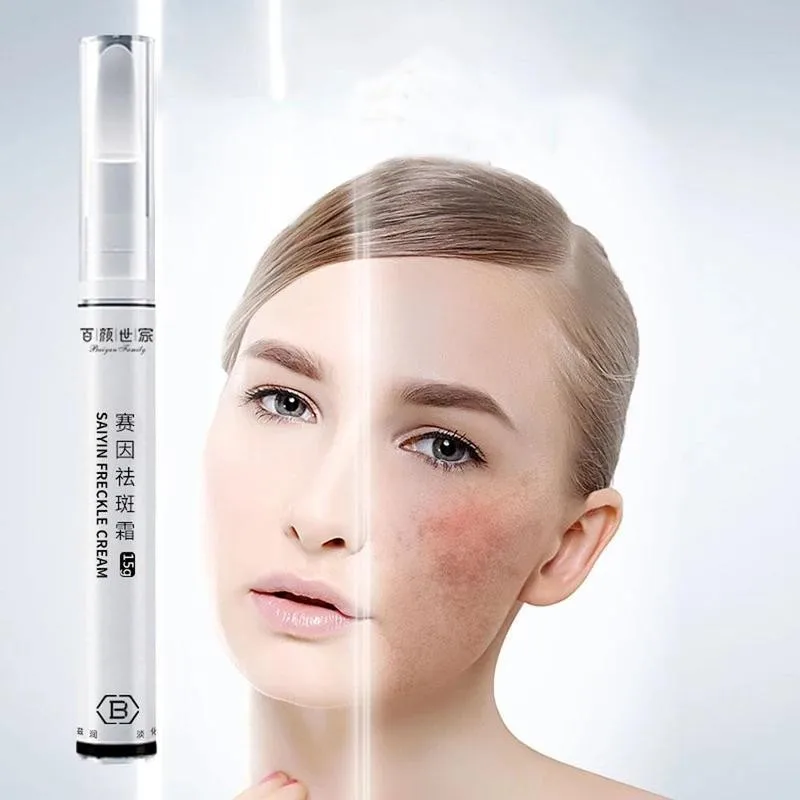 

15ml Whitening And Freckle Pen To Lighten Melanin Freckle And Freckle Cream Brighten Skin Tone And Fade Acne Marks Skin Care