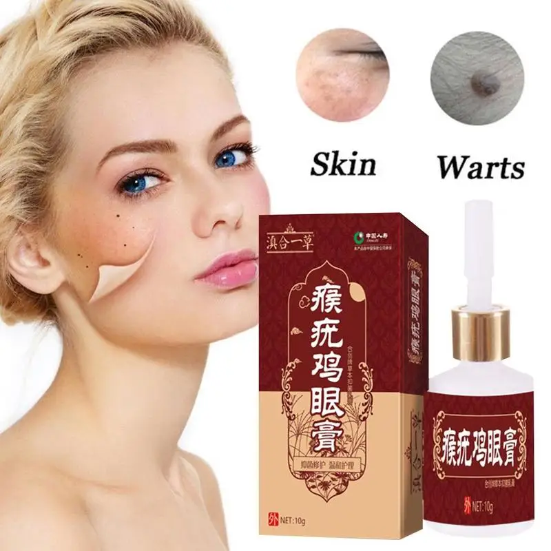 10 мл Машинка для удаления магнитных бирок кожных пятен Tu Kill Meat Thorn Mole Genital Wart Foot Corn