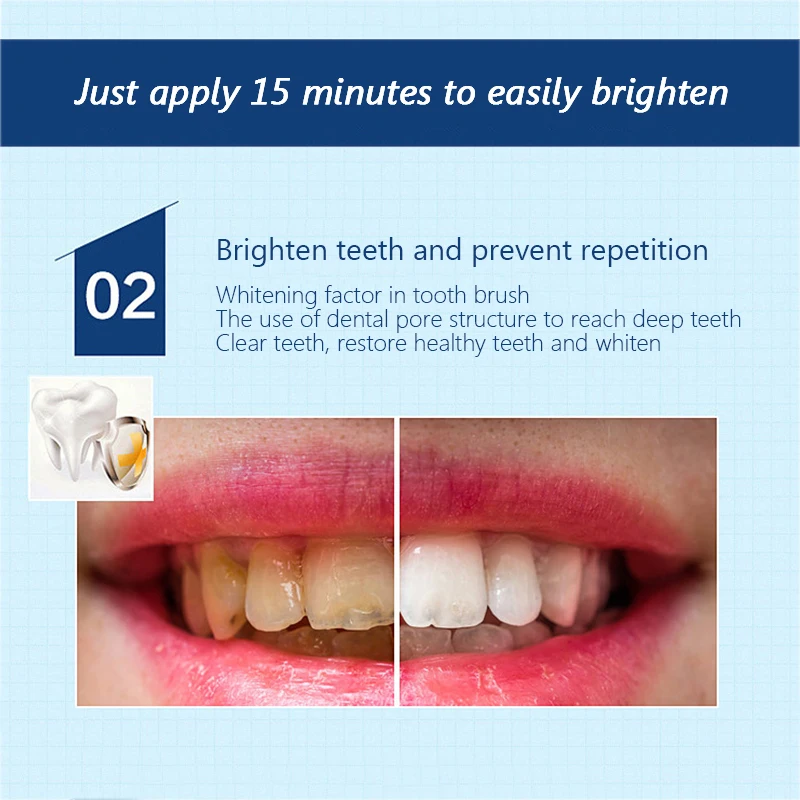 

Magic Natural Teeth Whitening Gel Pen Oral Care Remove Stains Tooth Cleaning Teeth Whitener Tools