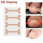 1632 шт., Ортодонтические Пластыри для вросших ногтей