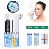 blackhead remover face pore cleaner vacuum acne remover black points pimple extractor sucker black dot electric facial cleaning