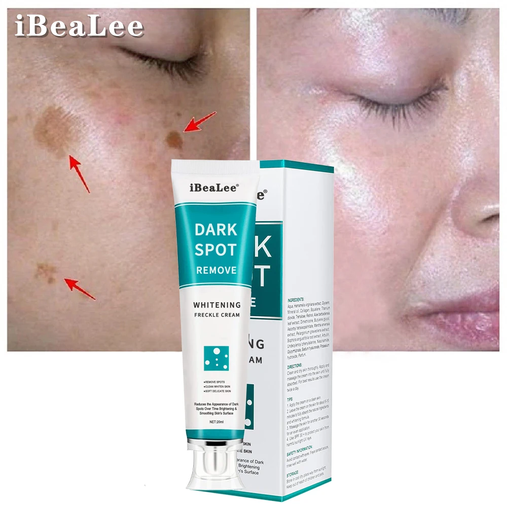 

iBeaLee Whitening Freckle Cream Remove Melasma Cream Remove Freckles Remove Dark Spots Melasma Remover Brighten Skin Anti-Aging