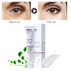 Крем для кожи вокруг глаз, мгновенное удаление мешков под глазами, укрепляющий, антивозрастной, увлажняющий, питательный, Осветляющий