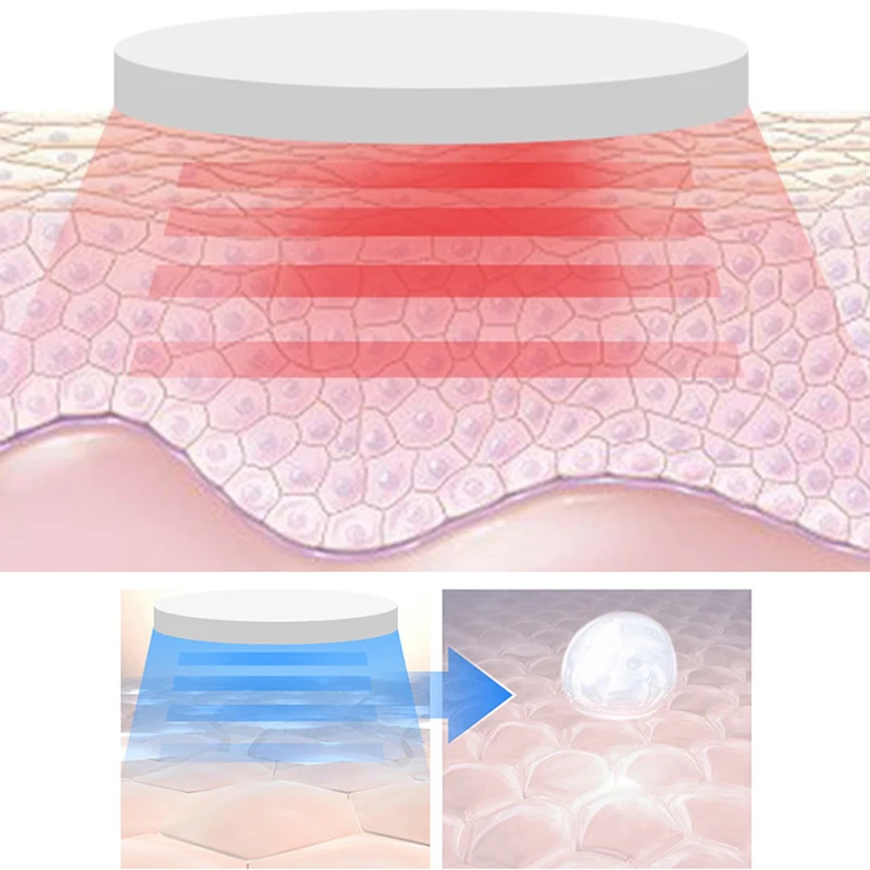 

1 Set Chin V-Line Up Lift Belt Machine Red Blue LED Photon Therapy Face Slimming Vibration Massager Facial Lifting Device