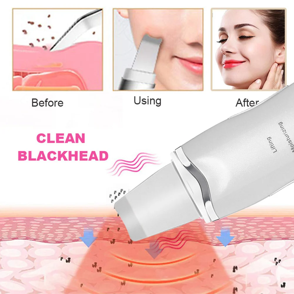 

Home Use Ultrasonic Skin Scrubber Facial Cleaner Blackheads Remover Gental Peeling Exfoliating Shovel Skin Firming Beauty Device