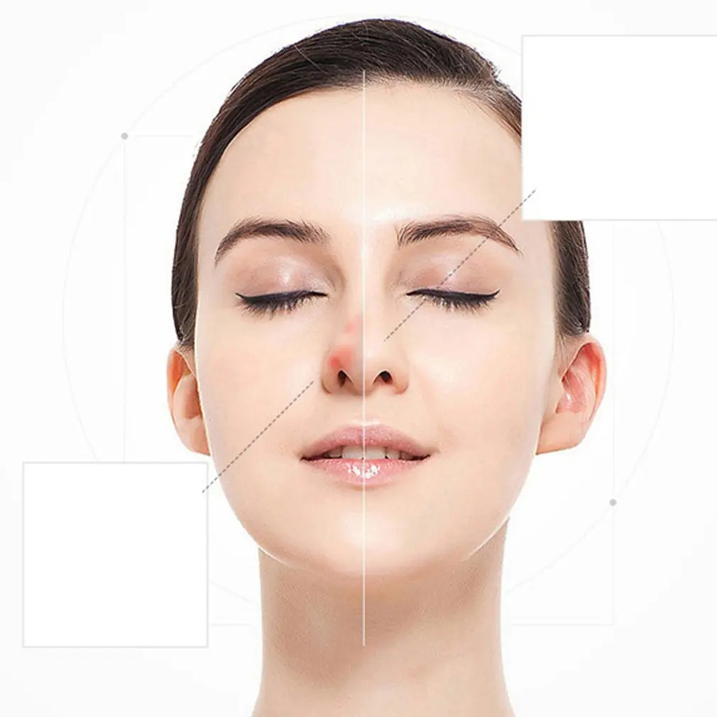 Микро Веснушка ручка Развертки Пятно машина портативный светильник для лица