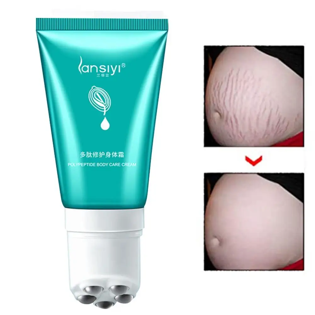 

Acne Scar Removal Face Cream Acne Spots Acne Pigmentation Corrector Care Repair Skin 30G Scar Anti Stretch Marks N7R5