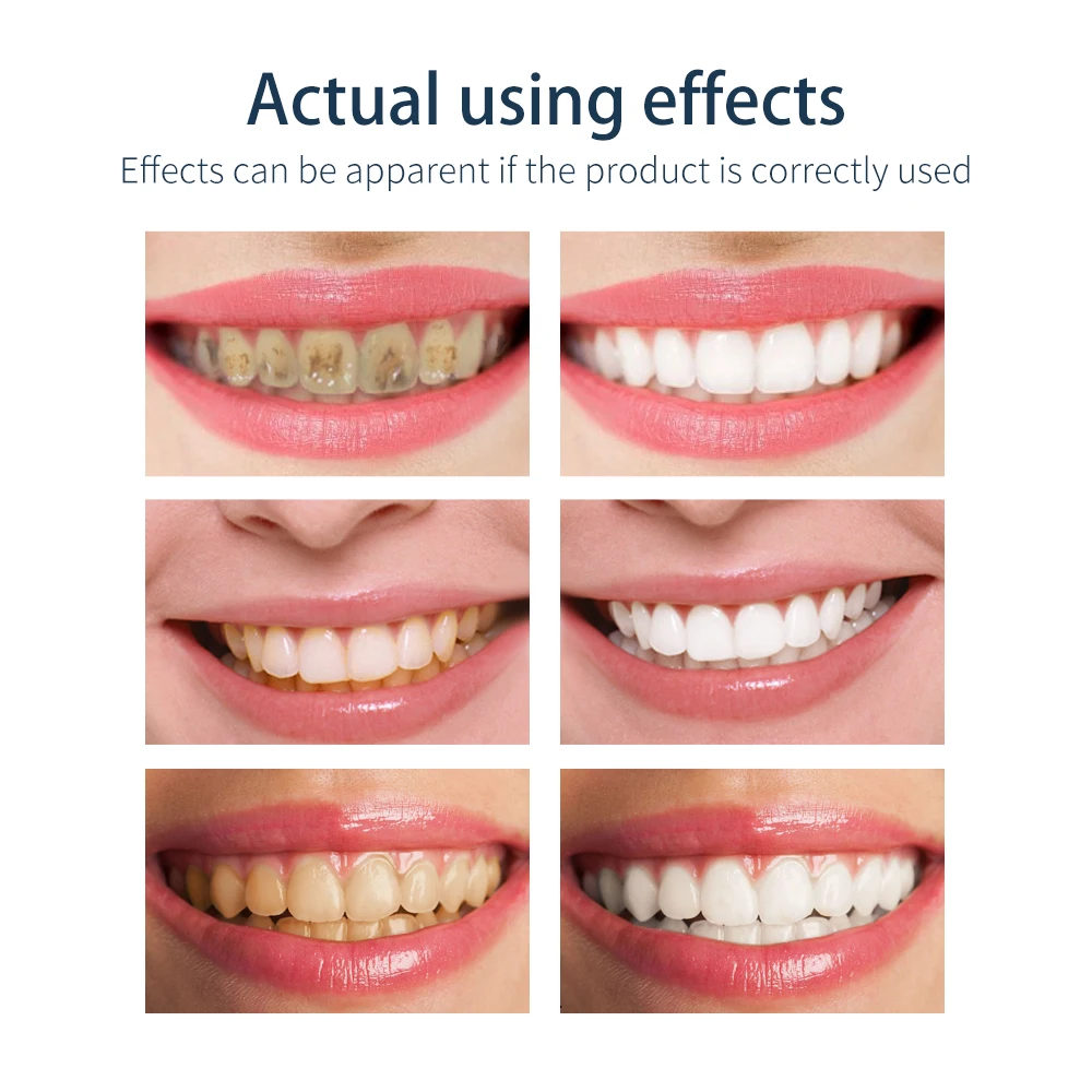Сияющий зубная паста для чистки зубов отбеливание гигиены полости рта удаляет