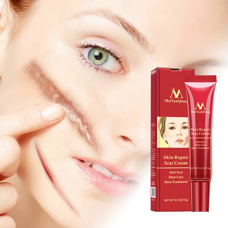 Крем для удаления шрамов от акне отбеливающий крем ухода за кожей лица против