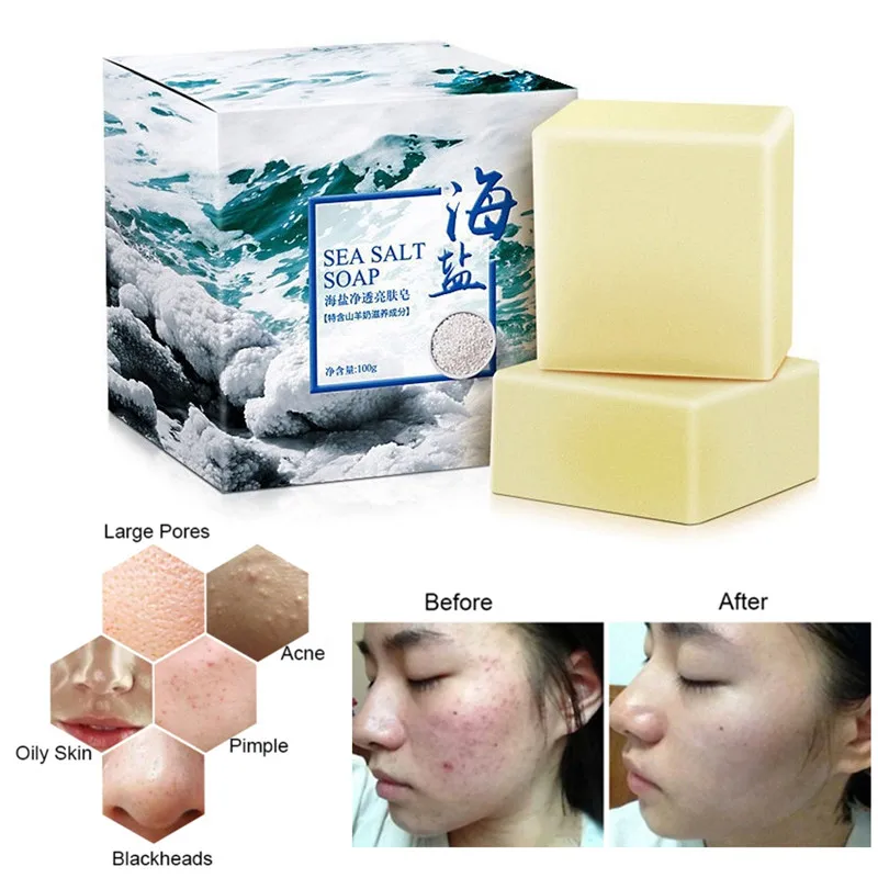 100 г мыло с морской солью очищающее средство для удаления прыщей ПОР лечения акне
