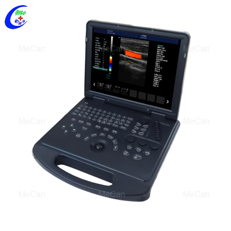 MCB-C60 15inch 3D 4D Laptop Color Doppler Portable Ultrasound Scanner