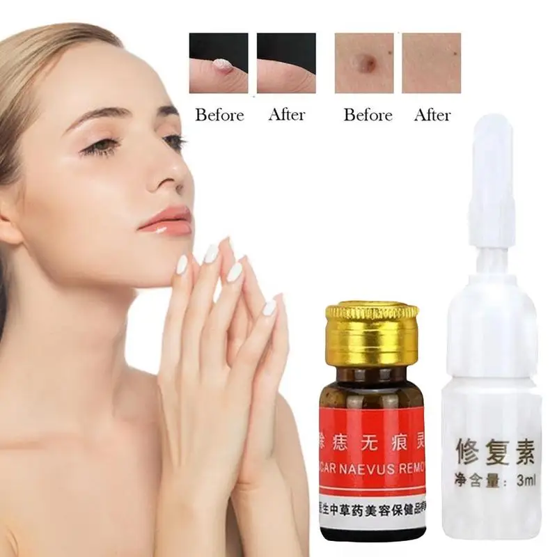 

1set Mole Water Moisturizing Tag Remover Serum Mole Solution Cream Skin Repair Face Solution Removal Care Tool Care Removal H2J4