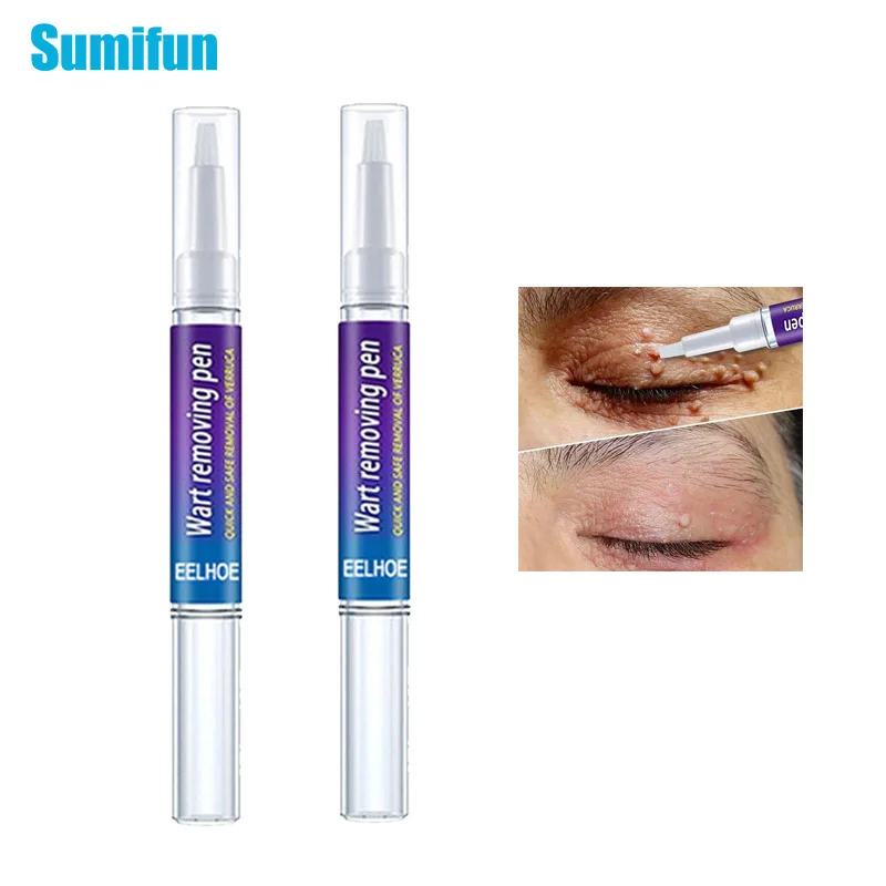 1 шт. жидкая ручка для удаления бородавок на лице | Красота и здоровье