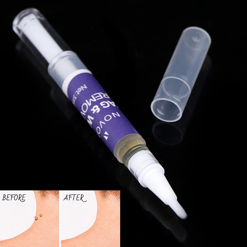 

Skin Tag Remover Against Mole & Genital Wart fast Removal Anti Foot Corn