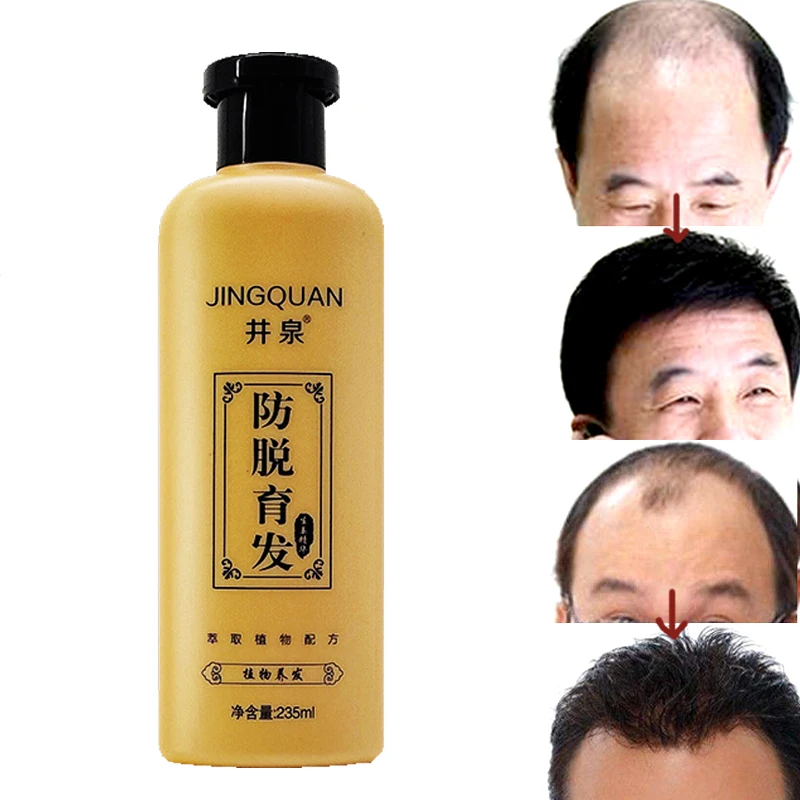 

Hair Loss Product hair care Rapid effects postpartum Seborrheic alopecia Restorer medicine densely growth shampoo cream Dandruff