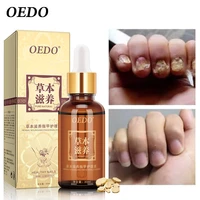 oedo herbal fungal nail treatment essential oil hand and foot whitening toe nail fungus removal infection nourish feet care 30g