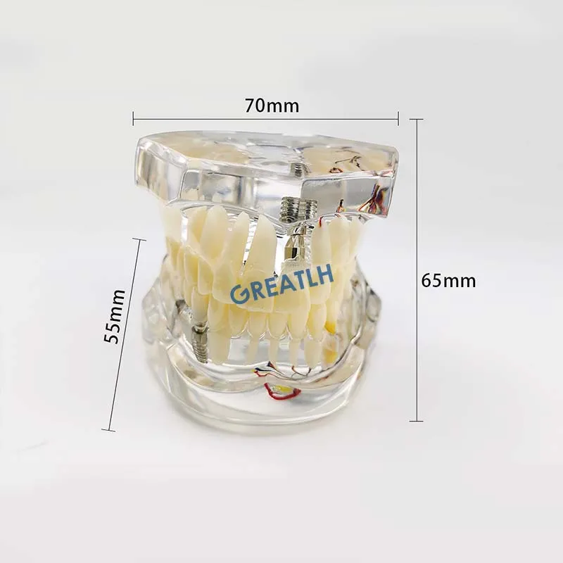 Оборудование для обучения стоматологическим заболеваниям стоматологический