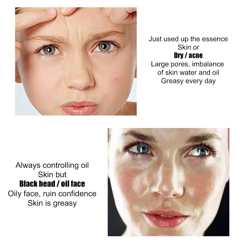 Сыворотка для лица 30 мл|Сыворотка| |