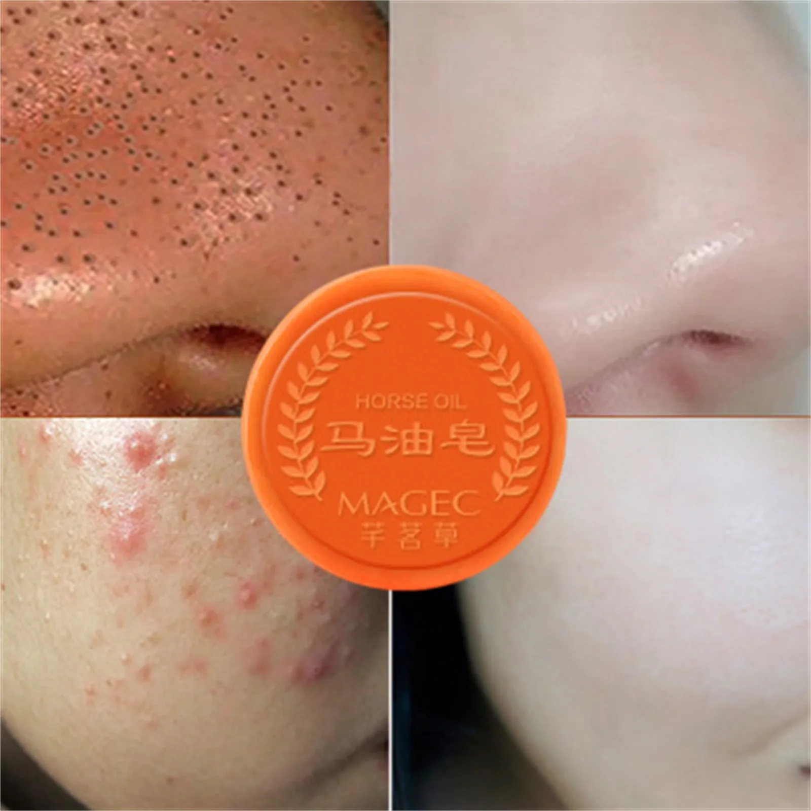 Очищающее Молочное мыло для удаления клещей очищающее масло лица очищение акне |