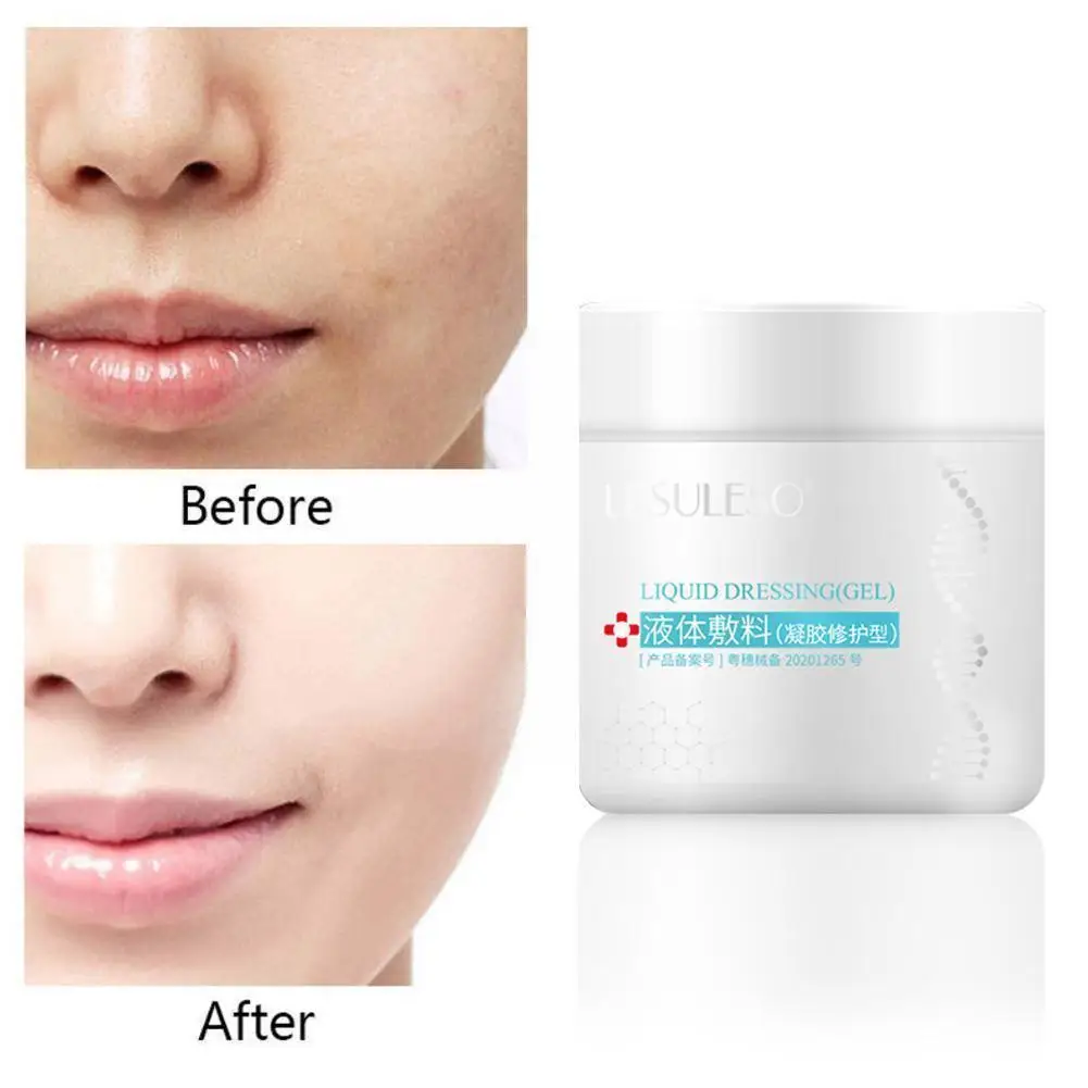 

200g Face Wound Repair Serum Corrector Professional Wound Regeneration Scar Mark Cell Healing Acne Repair And Cream P4a0