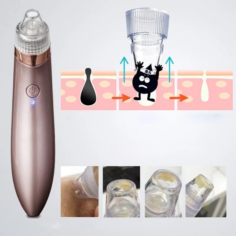 Микродермабразия машина Blackhead Вакуумный Очиститель акне устройство для удаления черных точек Электрический Уход за кожей лица D30916