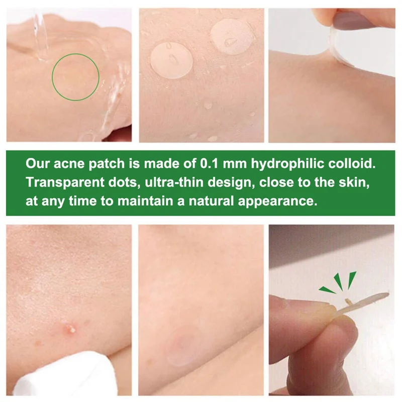 

Tea Tree Acne Patch Acne Stickers Hydrocolloid Waterproof Invisible Clear Pimple Patch Acne Treatment Patch Maquillaje Mujer