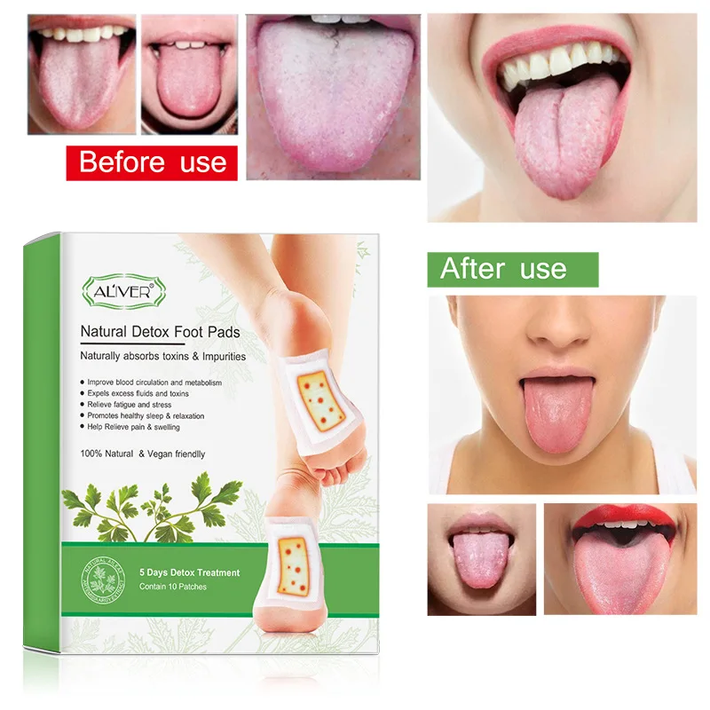 10 шт. имбирный Восстанавливающий Детокс пластырь для ног с приклеивающимися