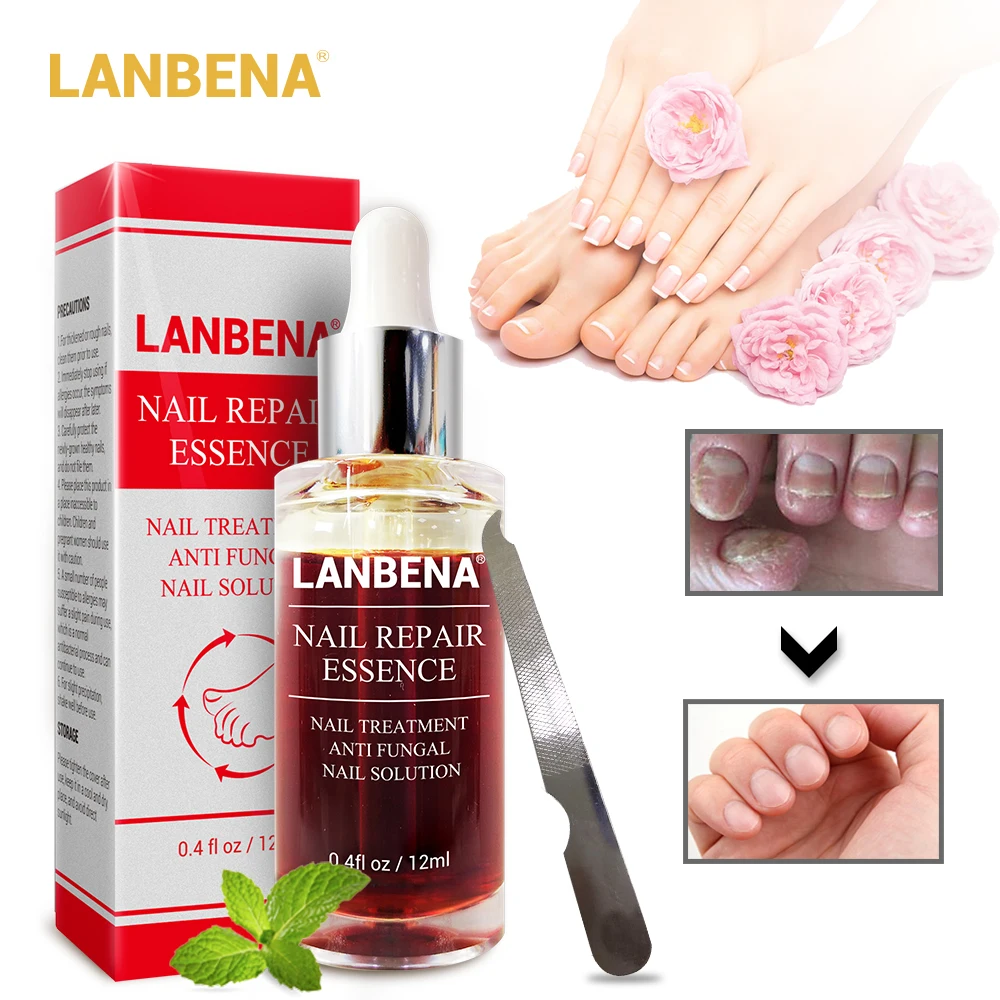 

LANBENA Nail Repair Essence Serum Softening Remove Onychomycosis Protect Cracked Rough Nails Nourishing Hand Feet Care 12ml