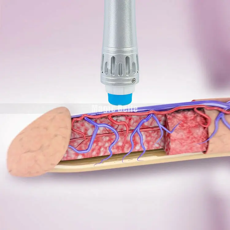 

Double Layer Mini Extracorporeal Shock Wave ED Treatment Pain Relief Cellulite Reduce Equipment