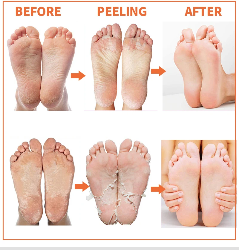 2 упаковки отшелушивающая маска для ног лаванды/папайи носки педикюра крем