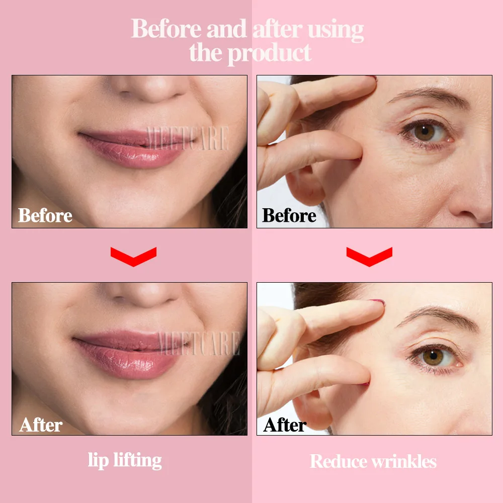 Ручка гиалуроновая с двумя насадками ампула гиалуроновой кислотой для подтяжки