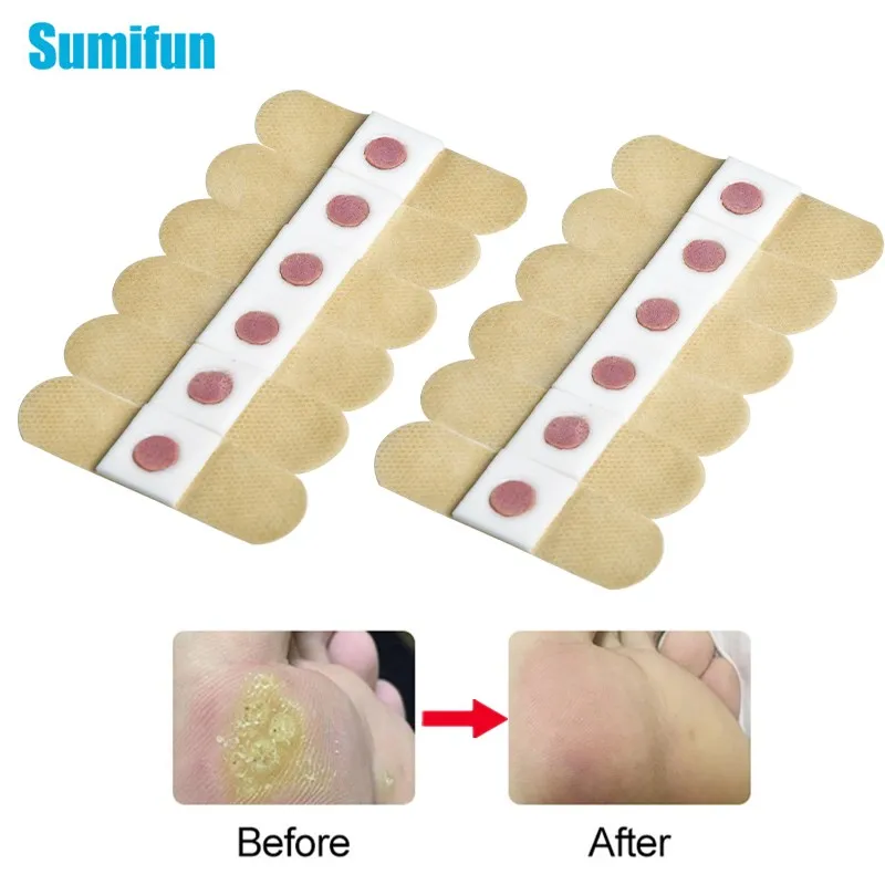 Sumifun 36 шт. мозоли для ног подошвенные деформации обезболивающие пластыри