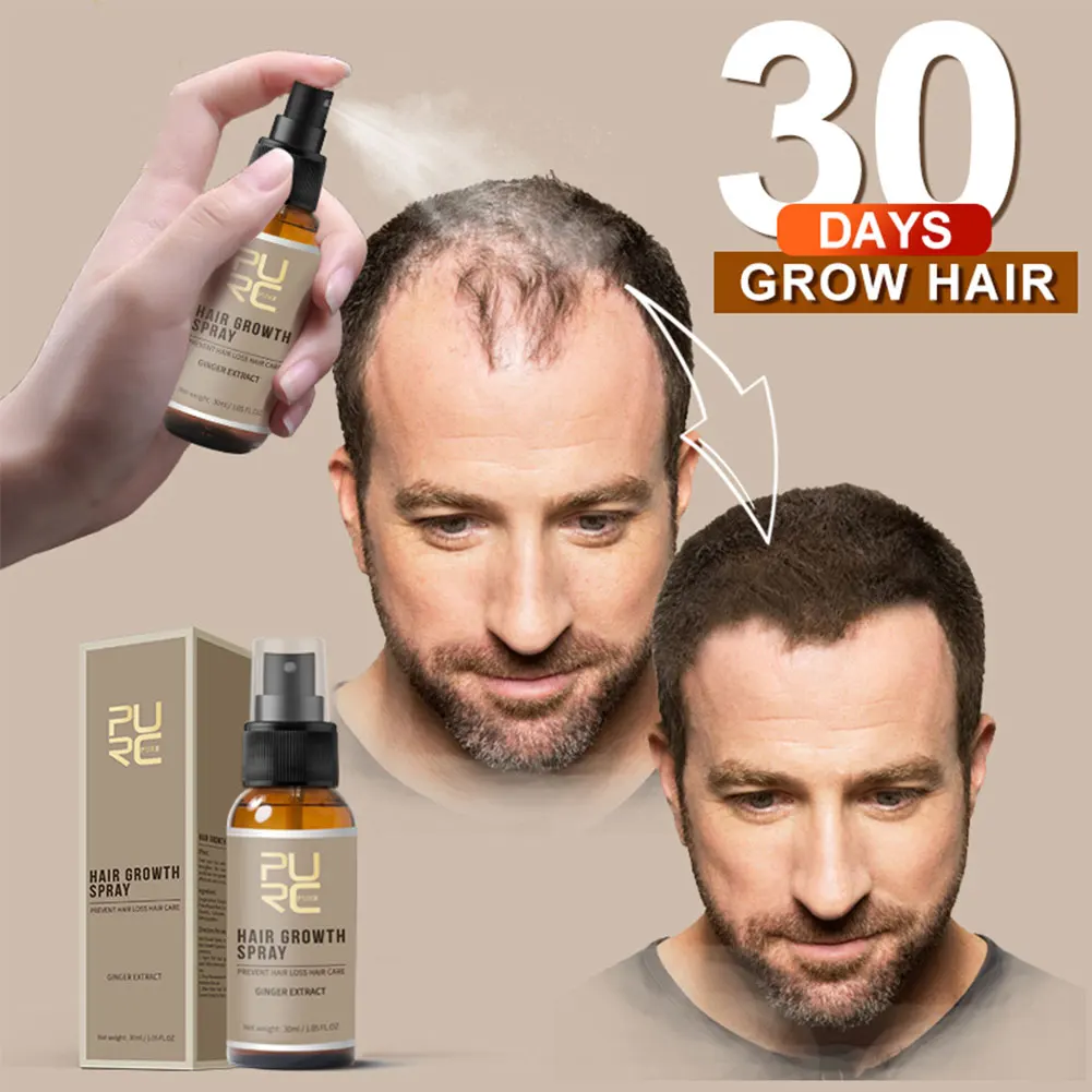 

New Hair Growth Spray Fast Grow Hair hair lossTreatment Preventing Hair Loss 30ml Hair Growth Spray for man