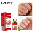 Средство для лечения грибков ногтей, эссенция для ухода за ногами, отбеливание ногтей на ногах, удаление грибка на ногтях, антиинфекционный гель для лечения паронихии и онихомикоза