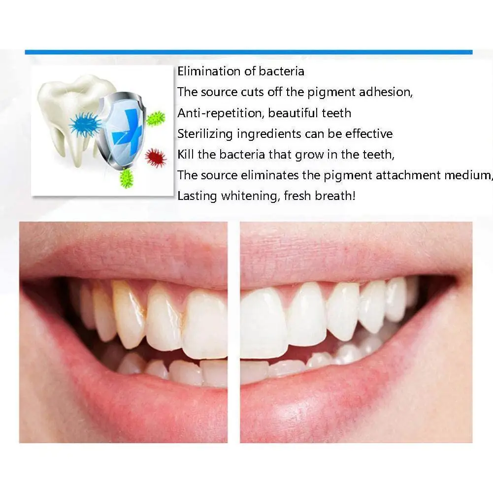 

Advanced Teeth whitening strips 14 pairs of yellowing strips S7C7