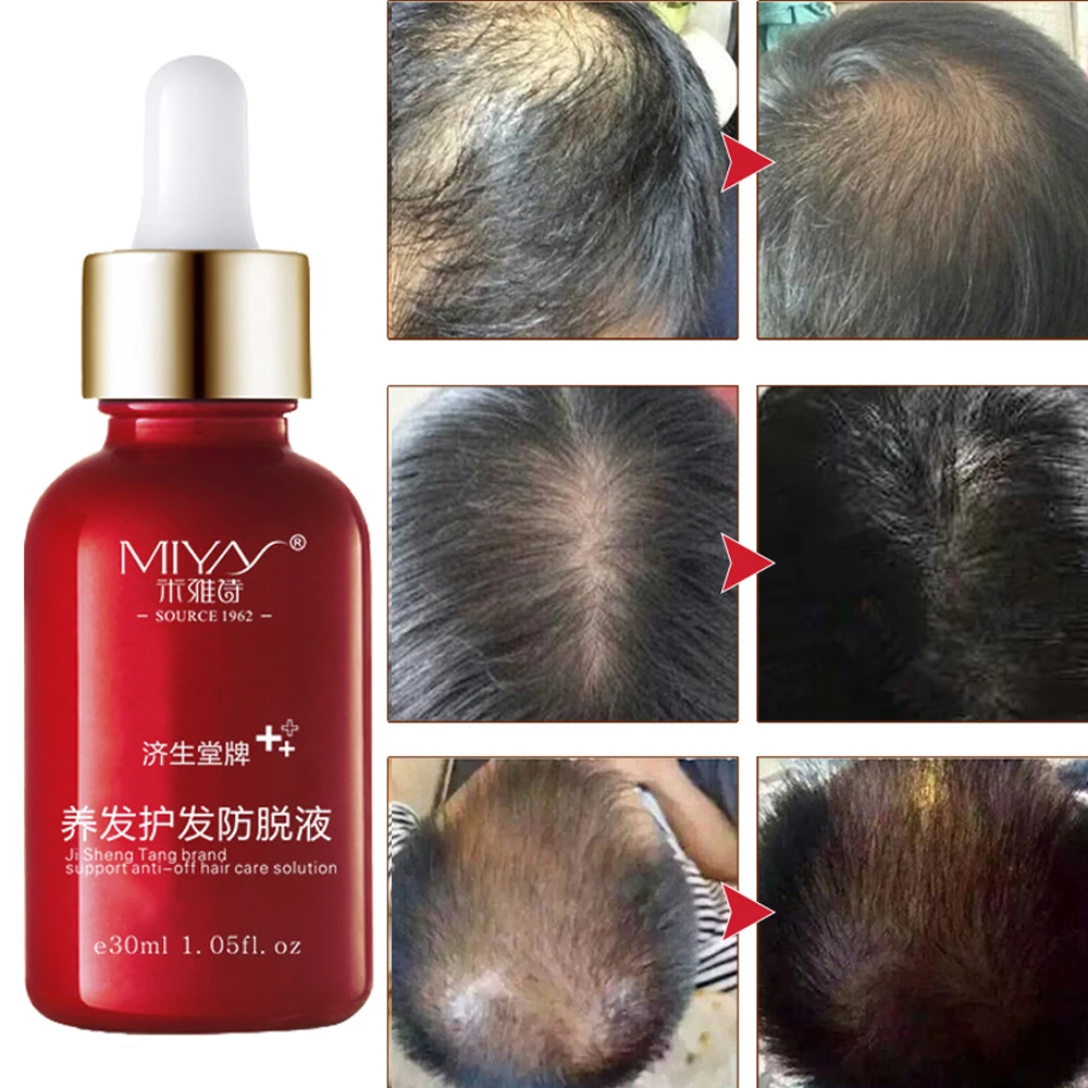 Масло для волос уход за волосами быстрое мощное средство роста эссенция жидкость