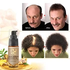 Средства для роста волос, быстрорастущее масло для волос, спрей для ухода за волосами, красота уход за волосами и кожей головы, для мужчин, женщин, предотвращение выпадения волос