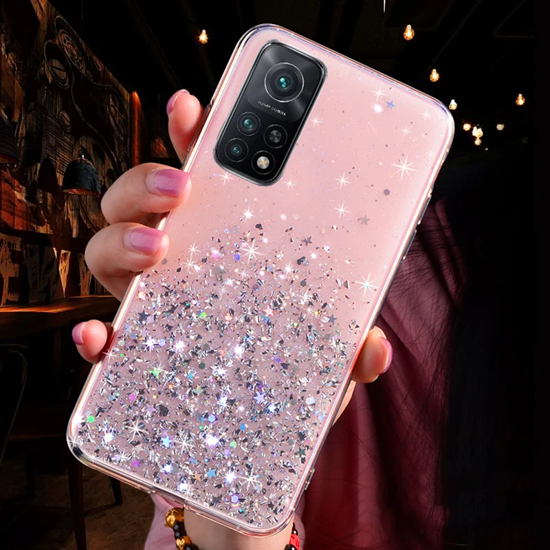 

For Xiaomi Redmi K40 Case Luxury Bling Glitter Star Soft Cover For Xiaomi Xiomi Redmi K40 Pro Cases K40Pro Silicone Covers Funda