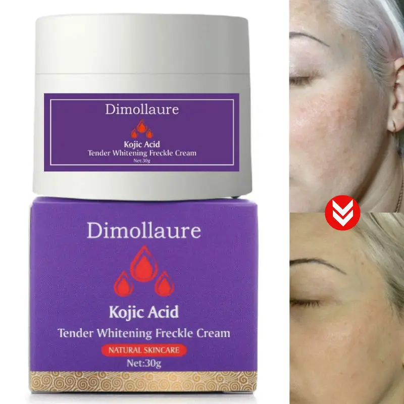 

Dimollaure Kojic Acid Whitening Face Cream Pigment Melanin Removal Age Spots Freckles Melasma Dark Spots Vitamin C Face Care