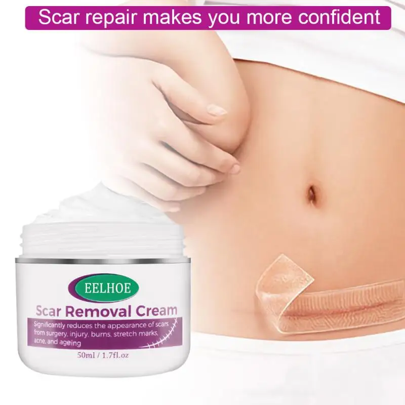 Восстанавливающий шрам крем для удаления шрамов кесарева хирургии уменьшения