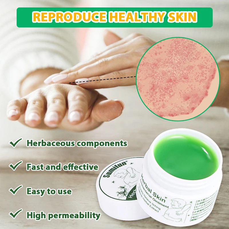 

10g/ bottle Mint Antipruritic Ointment Mosquito Repellent Cream Refreshing Treat Headache Cold Mosquito Bites Anti Itch Plaster