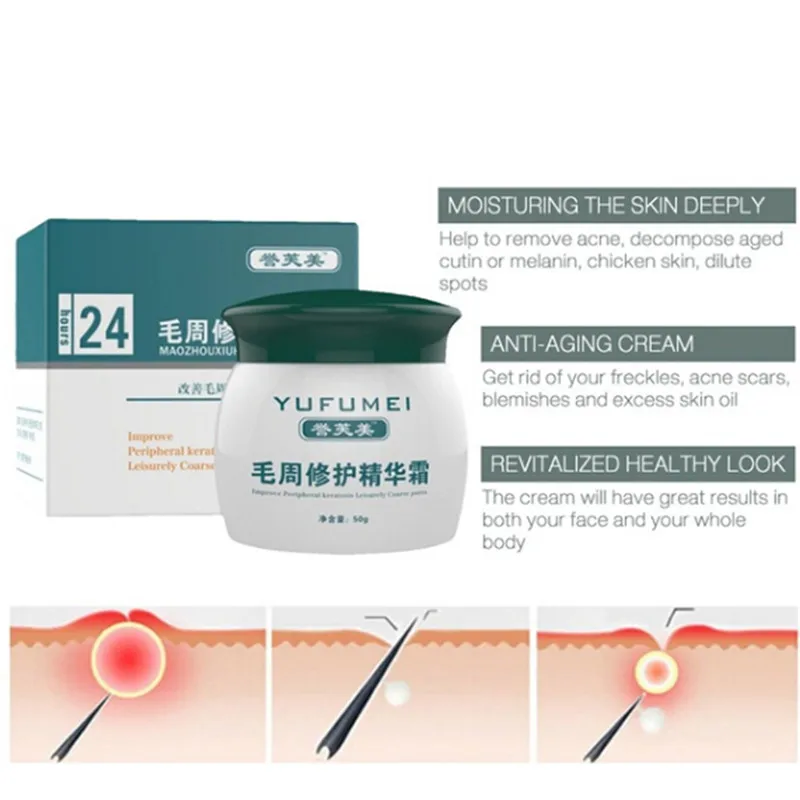 

50g Curing Keratosis Pilaris/ Kp/ Chicken Skin Body Lotion Skin Repair Cream Skin Care Essence Moisturizing And Nourishing