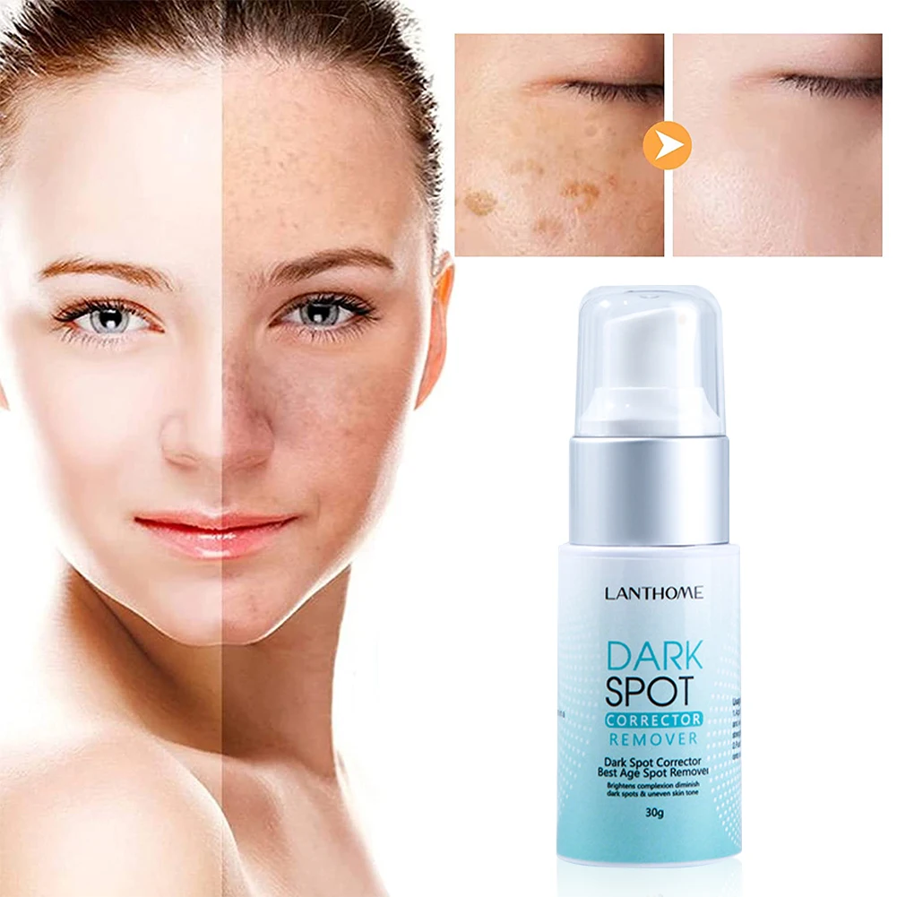 

Whitening Freckle Cream Face Moisturizing Remove Dark Spots Melanin Melasma Remover Brightening Skin Effective Repair Anti-Aging