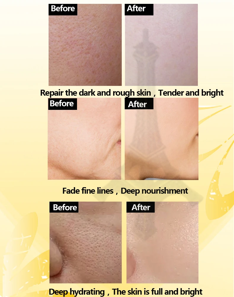 

Mango Skin Care Whitening Bright Moisturizing Face Serum Hyaluronic Acid Face Care Repair Rough Skin Essence Anti-wrinkle