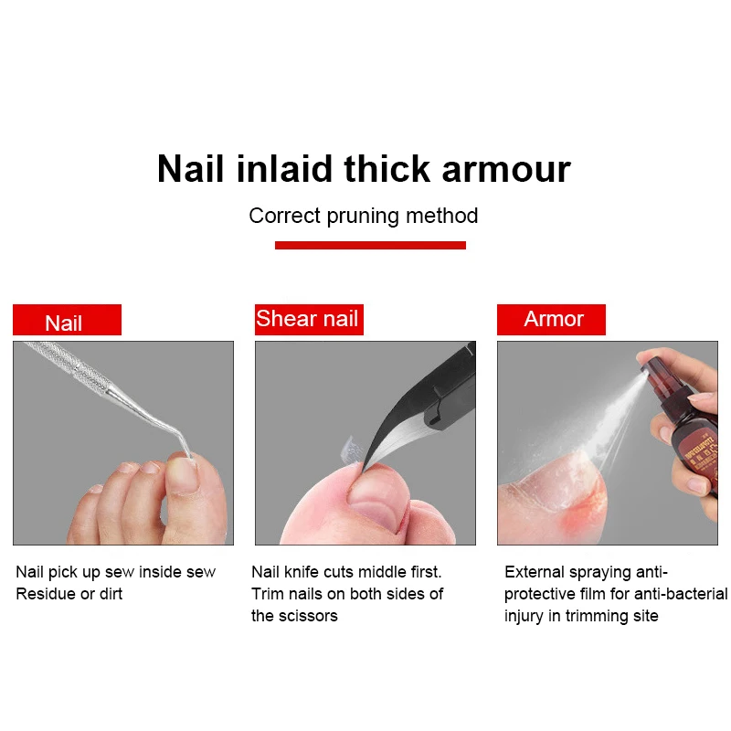 

Professional Nail Clipper Nail Correction Thick Nails Ingrown Toenails Nippers Dead Skin Dirt Remover Paronychia Tool Nail Tools