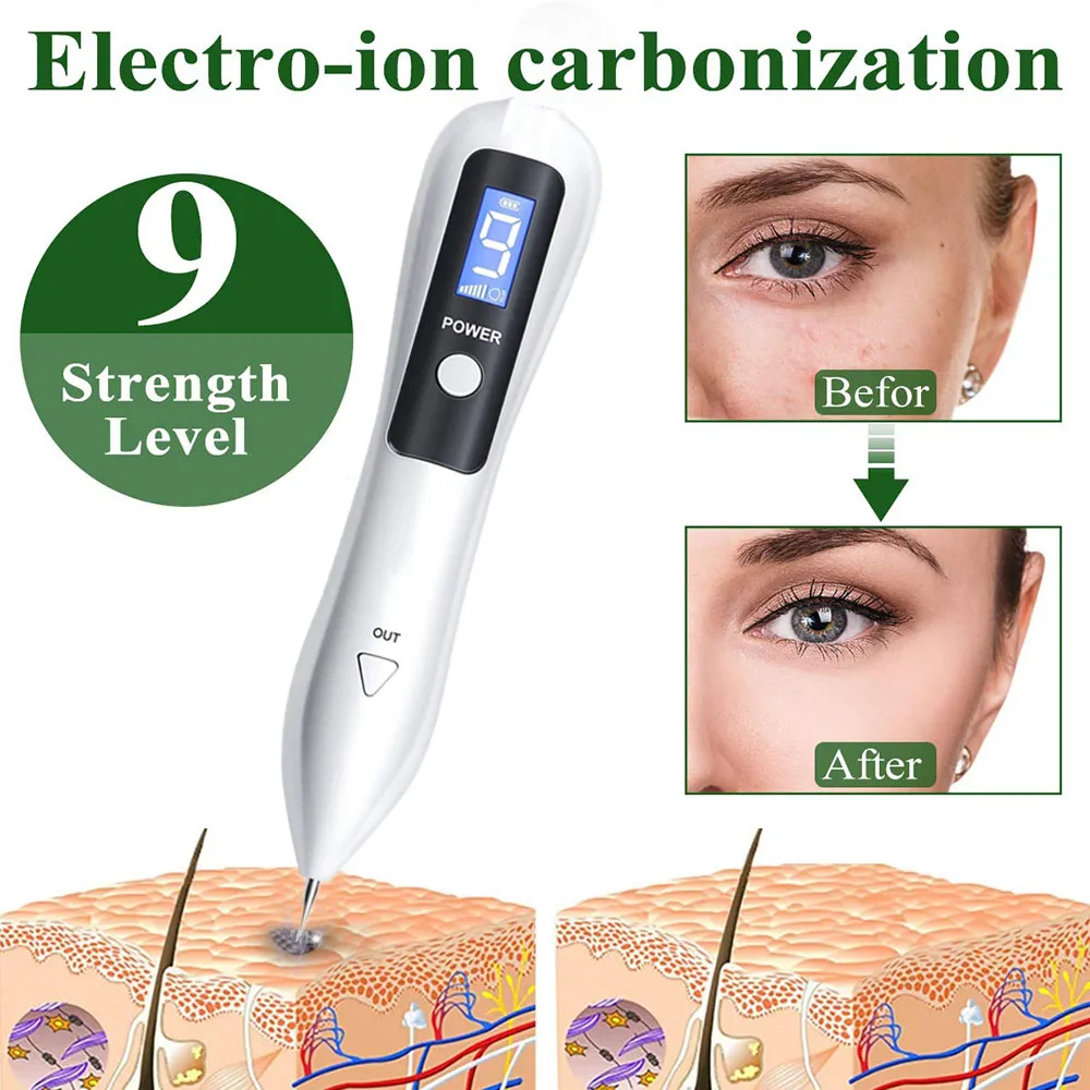 Лазерная плазменная ручка с ЖК-дисплеем инструмент для удаления черных точек