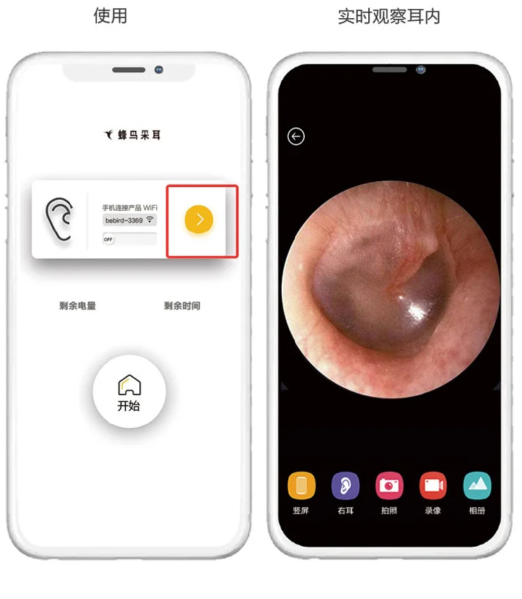 WiFi отоскоп визуальный очиститель ушей с беспроводным адаптером инструмент для