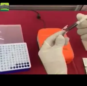 

Progesterone analyzer medical vet Medical Veterinary Progesterone Detector YSVET-YT8A Canine Progesterone Analyzer